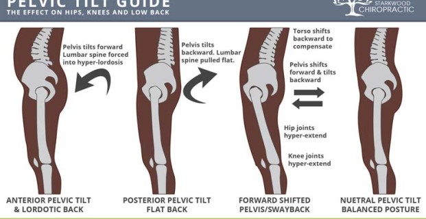 Image result for pelvis tilt